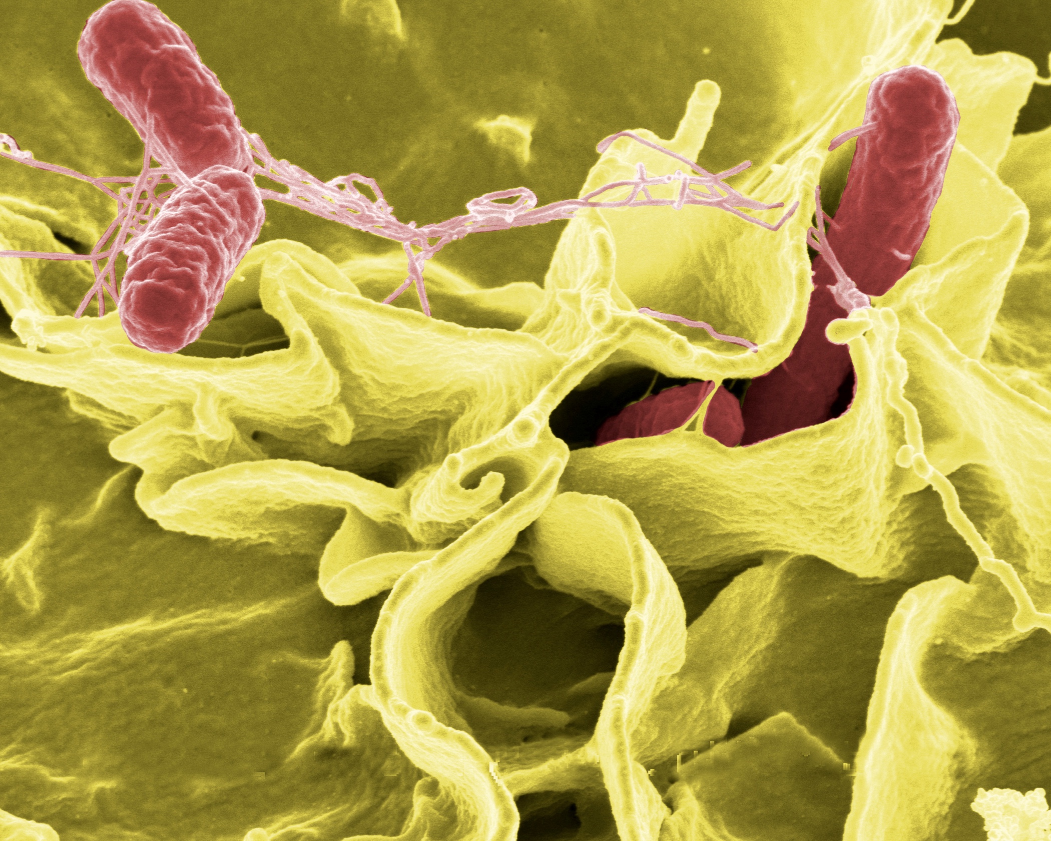 Salmonella up close: the microbe responsible for a rising number of food poisoning cases in Australia.
