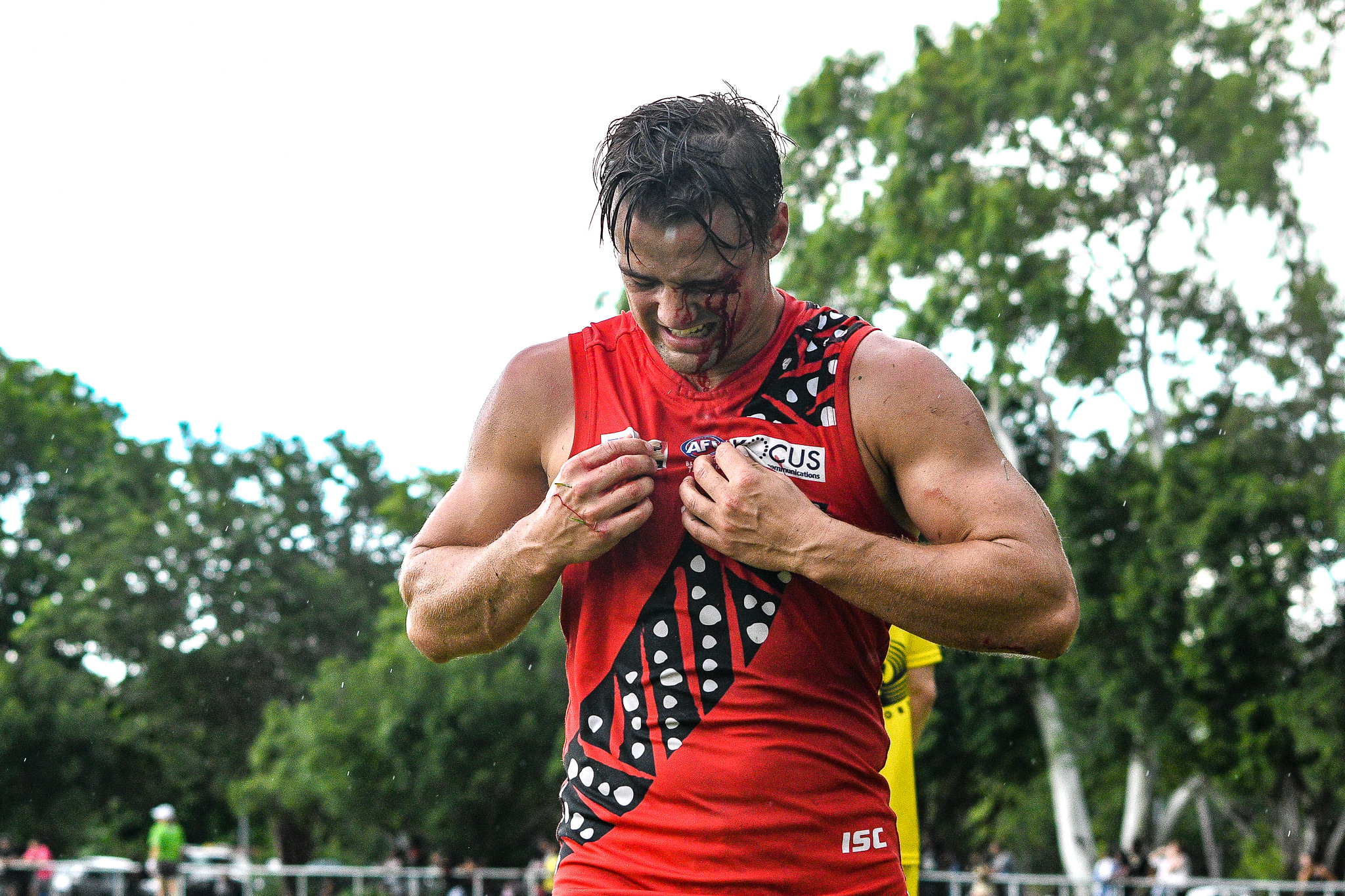 Christian Burgess, from Vermont Football Club in Melbourne, comes off in the closing minutes with a gash over his eye. Tiwi Bombers v Nightcliff Tigers, NTFL round 15, January 27, 2019.